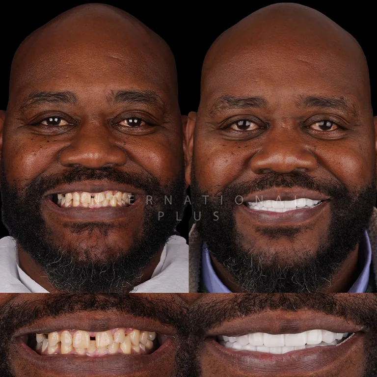 Performance-Based Dentistry