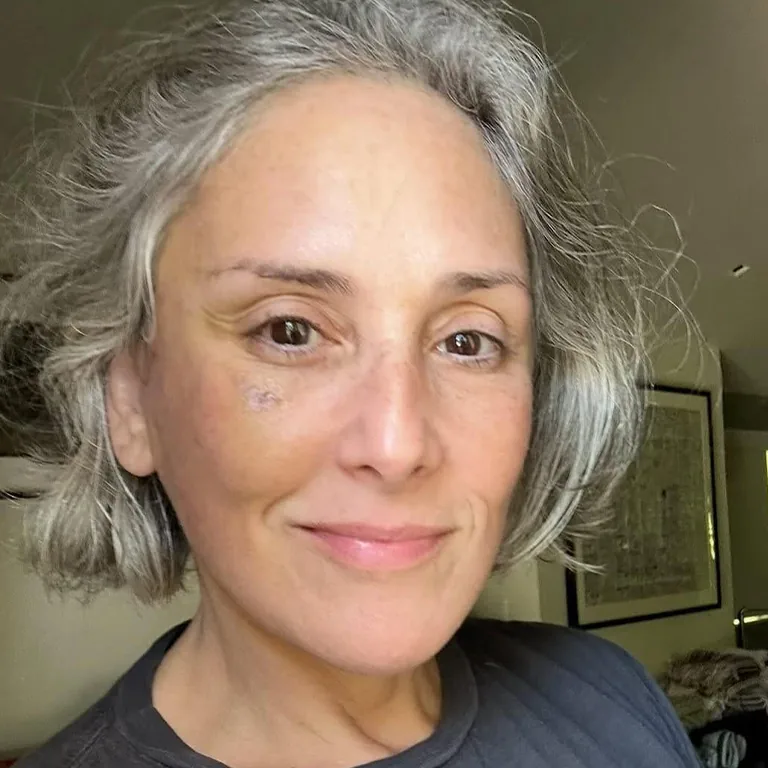 Ricki Lake Before and After Photos