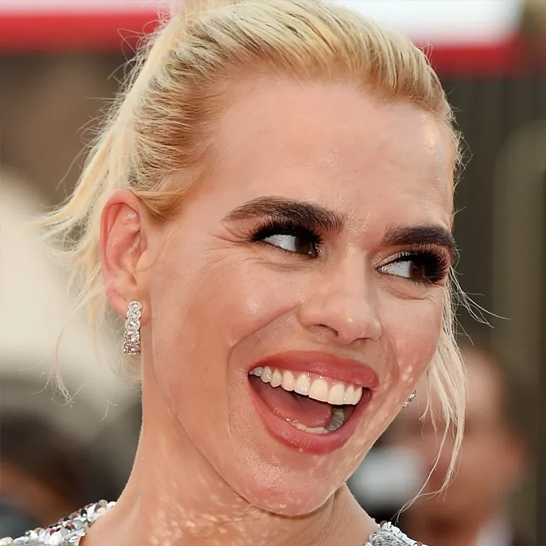 The Science of Big Teeth and Facial Longevity