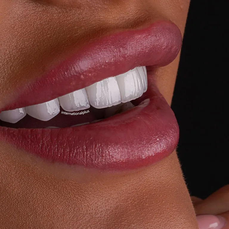 Veneers vs Bonding Longevity Comparison