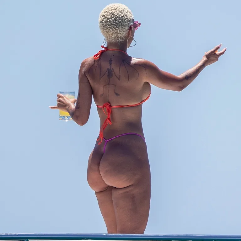 Doja Cat Plastic Surgery 2026 Confirmed Procedures