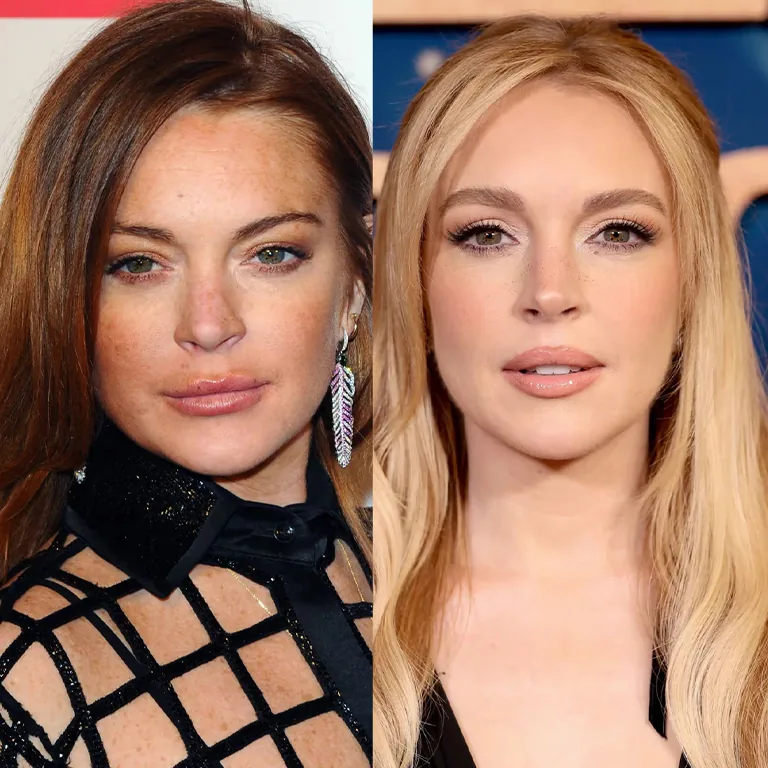 Lindsay Lohan Facelift Before and After 2026