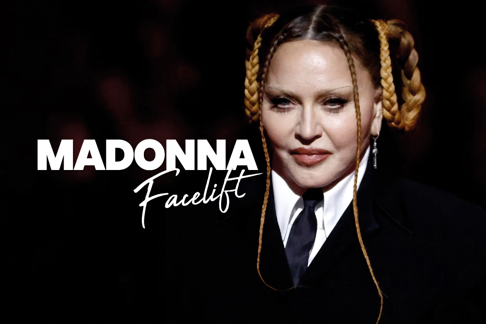 Madonna Facelift 2026 Update
