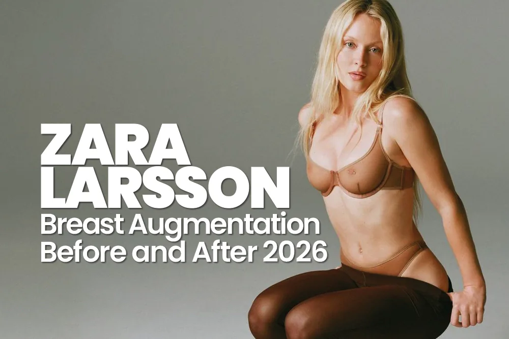 Zara Larsson Breast Augmentation Before and After 2026