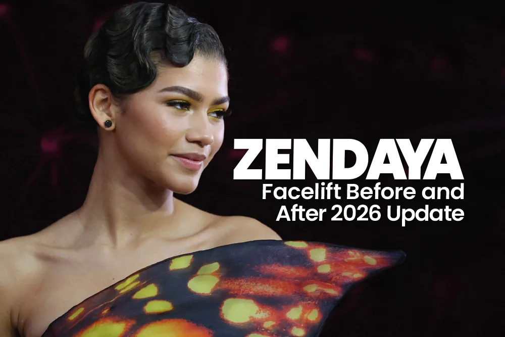 Zendaya Facelift Before and After 2026 Update