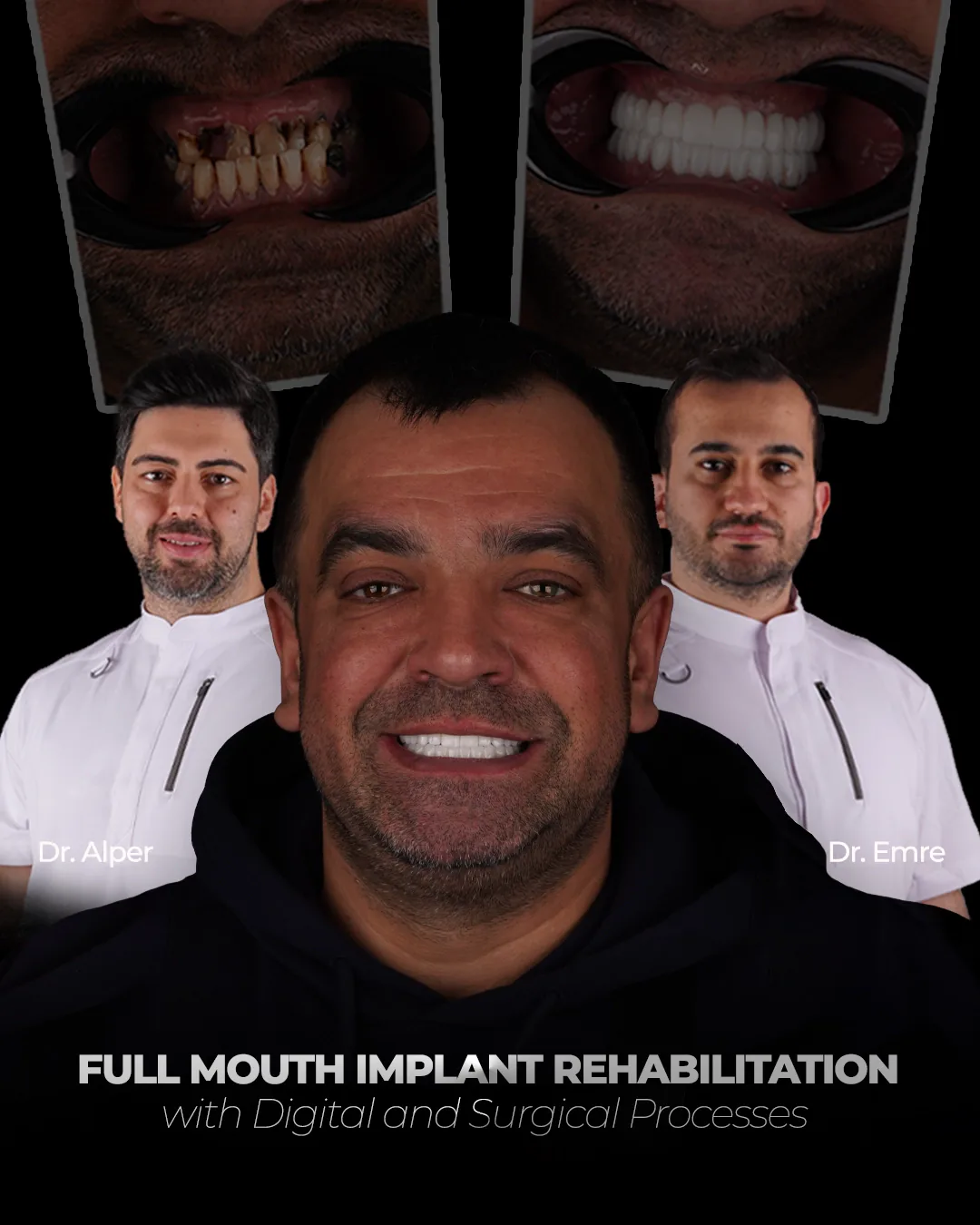 Advanced Digital Impression Technology
