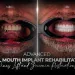 Advanced Full Mouth Implant Rehabilitation Sinus Lift and Zirconia Restorations