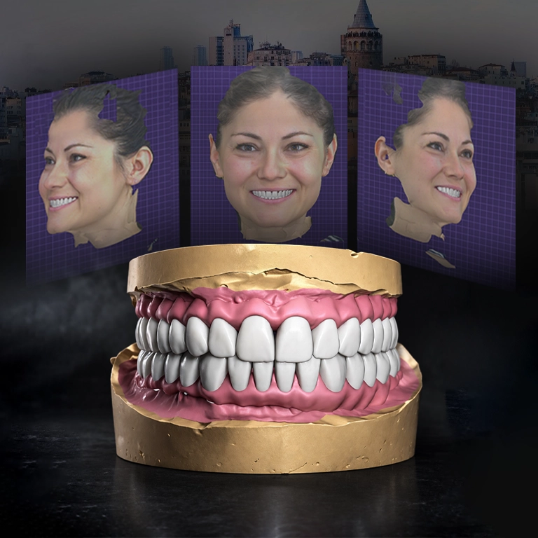 Digital Smile Design in Turkey Istanbul