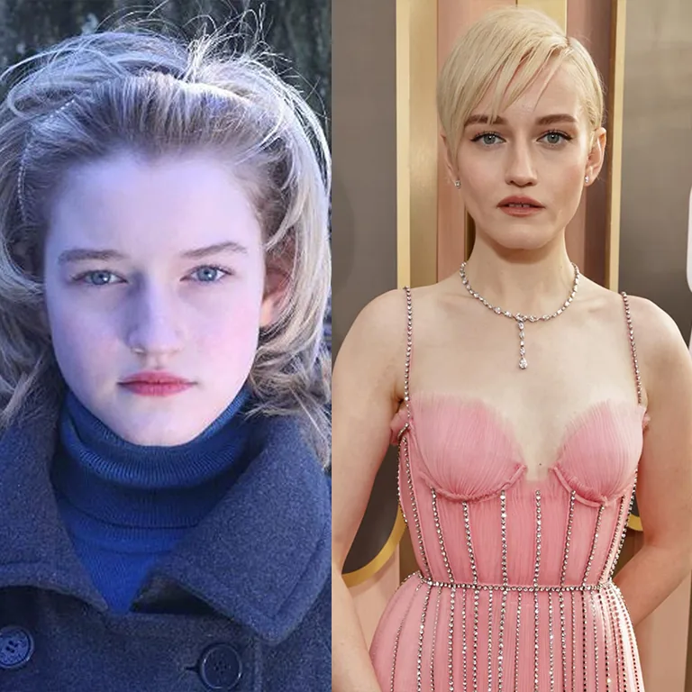 Julia Garner Plastic Surgery Before and After 2026