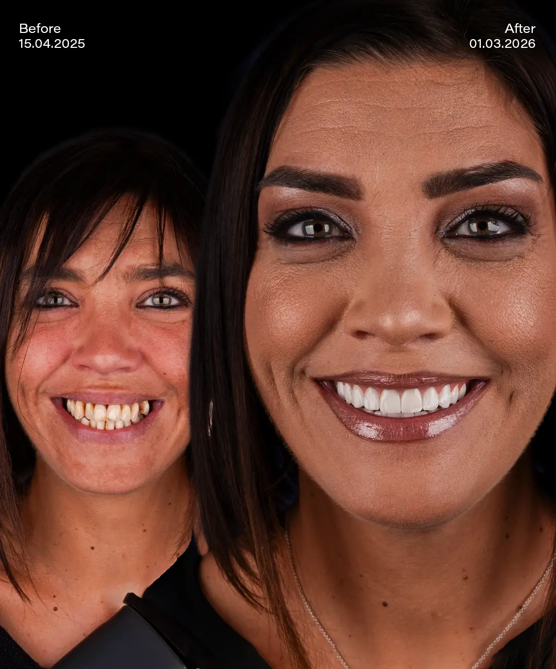 Toronto Dental Systems Before After 1