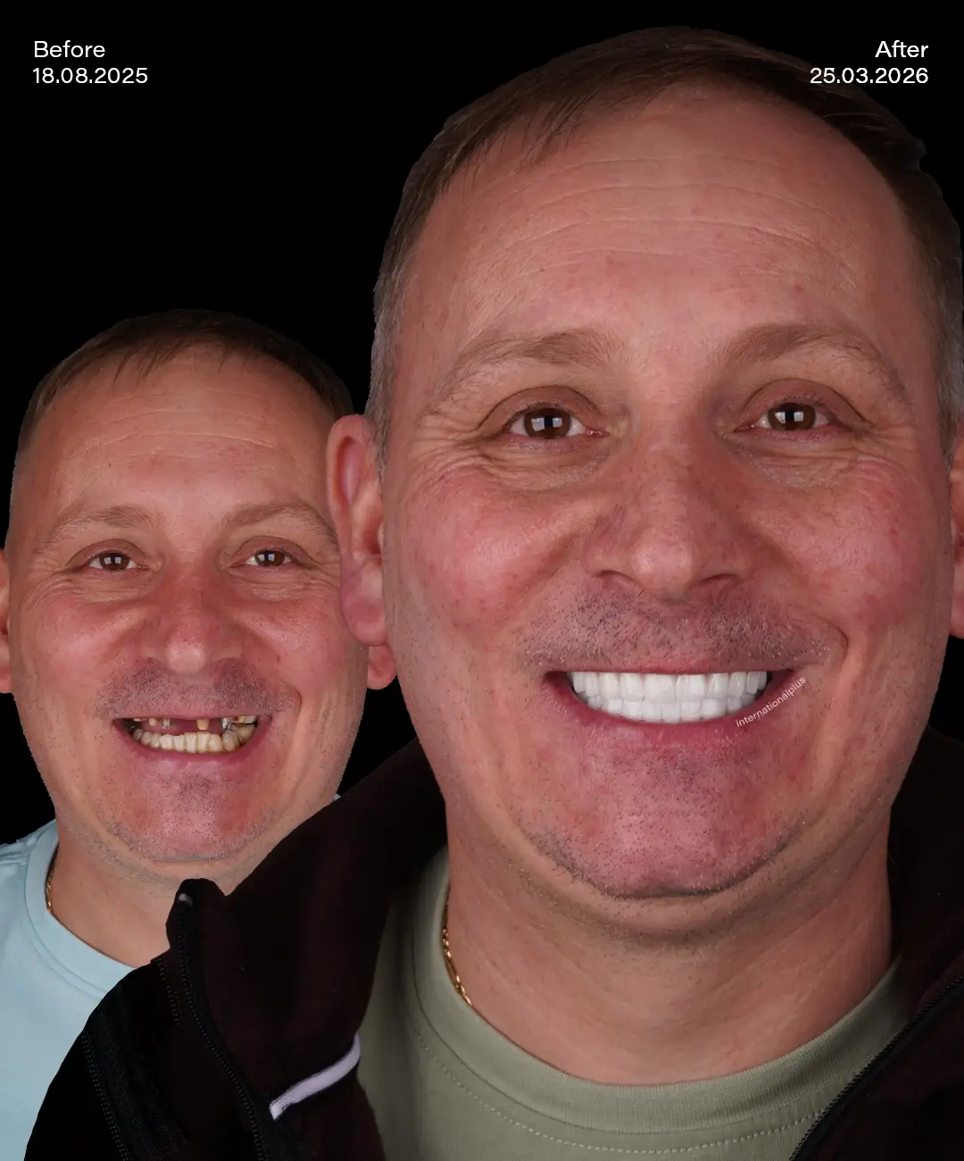 Toronto Dental Systems Before After 2
