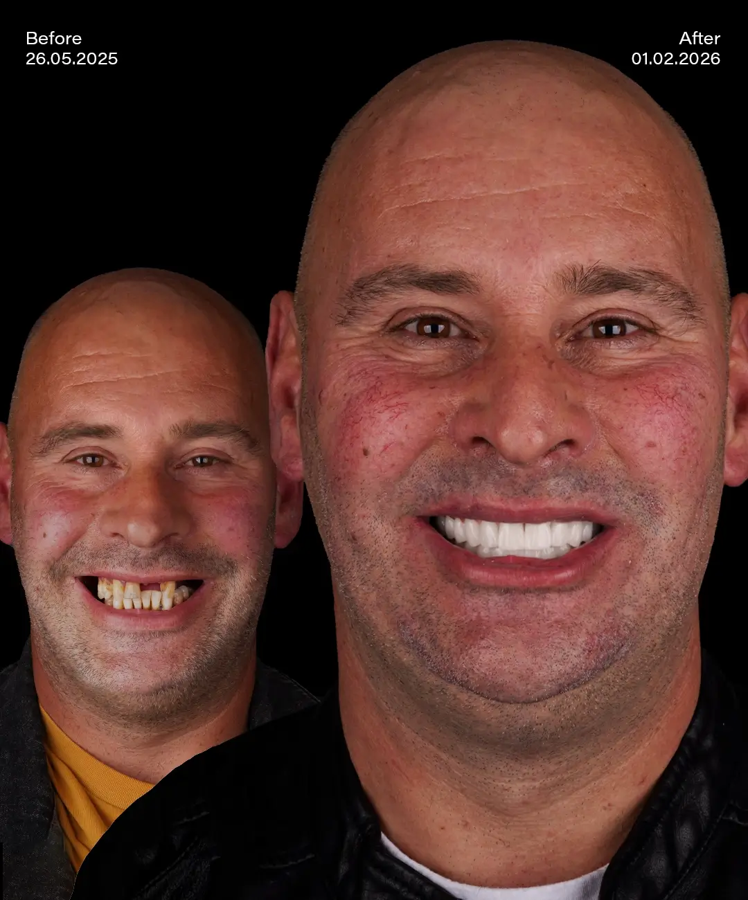 Toronto Dental Systems Before After 7