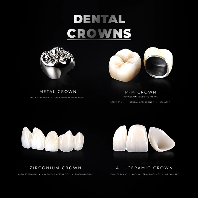 What Are Dental Crowns