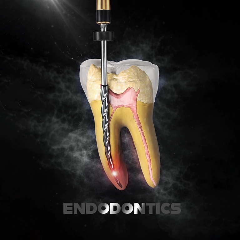 What Are Endodontics