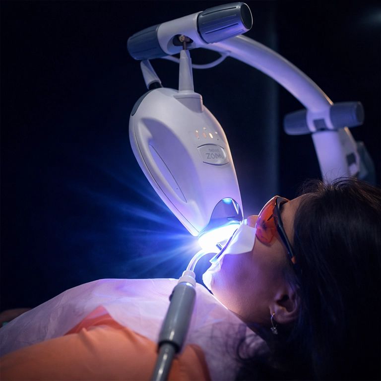 What Are Teeth Whitening