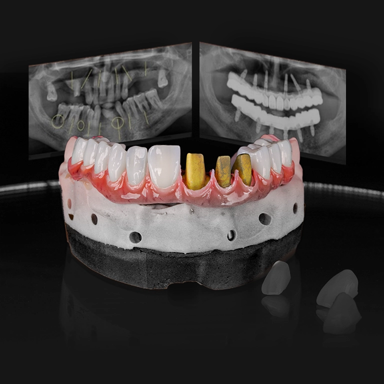 What Are Toronto Dental Systems