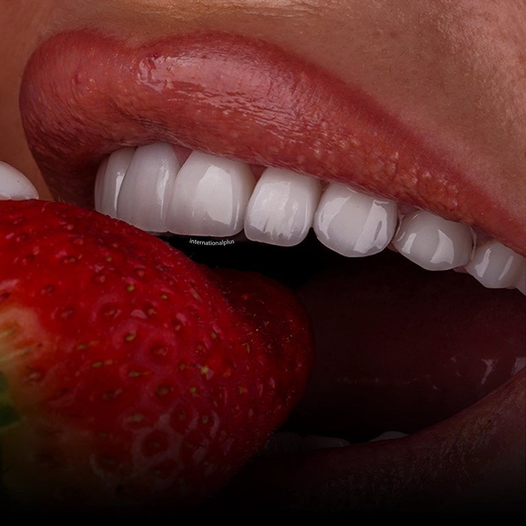 Why Choose Istanbul for Emax Veneers