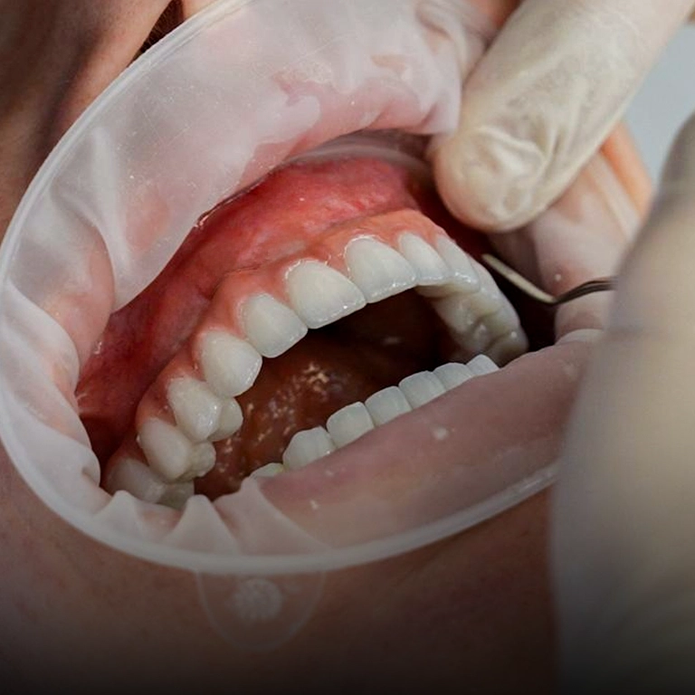 Why Choose Istanbul for Toronto Dental Systems