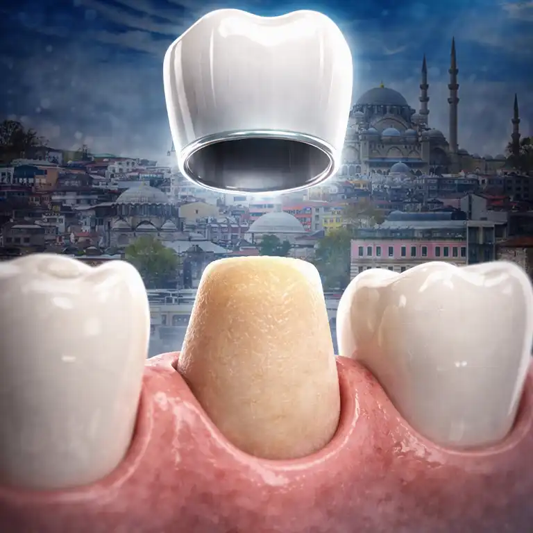 Zirconia Crowns in Turkey Istanbul