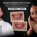 Beyond Cosmetic Expectations When Comprehensive Diagnosis Reveals Hidden Dental Disease in Turkey, Istanbul