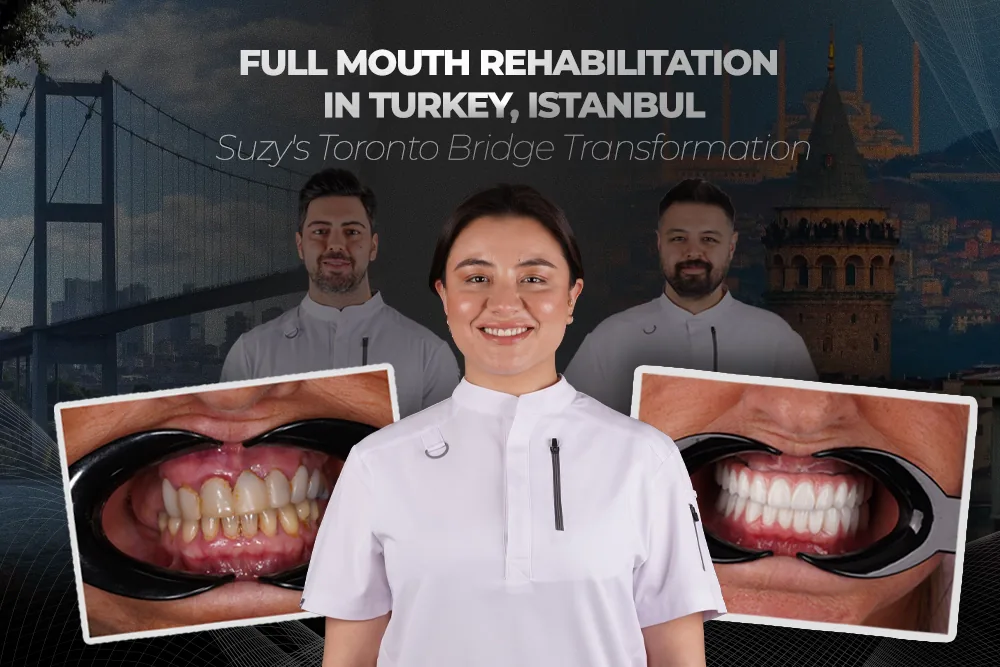 Full Mouth Rehabilitation in Turkey, Istanbul: Suzy’s Toronto Bridge Transformation