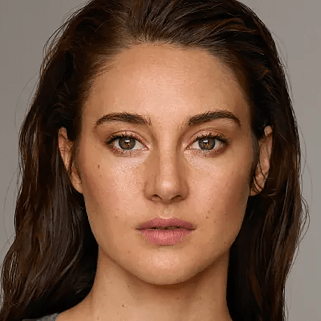 Shailene Woodley Plastic Surgery Rumors Real or Fake
