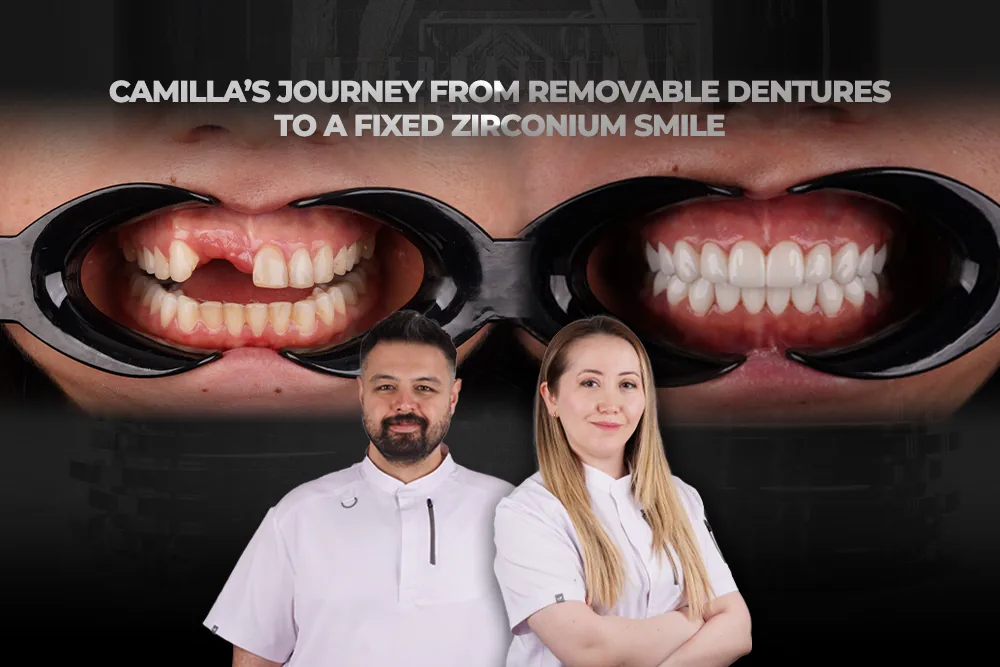 Smile Makeover Case Study: Denture to Fixed Zirconia Teeth