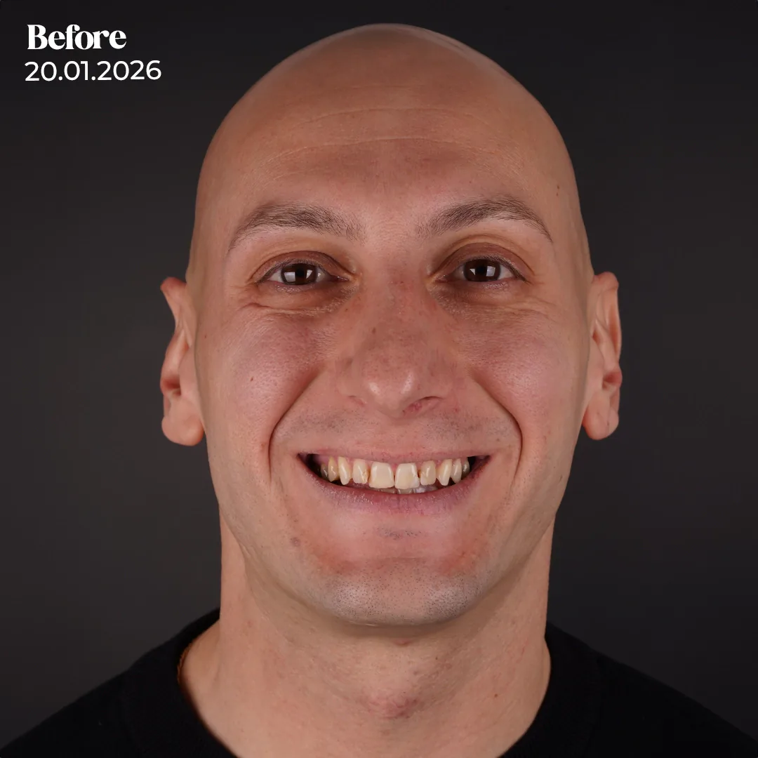 The Two Visit Model Balancing Efficiency with Biological Requirements