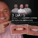 Three Day Smile Transformation in Turkey, Istanbul When Clear Communication Meets Clinical Excellence