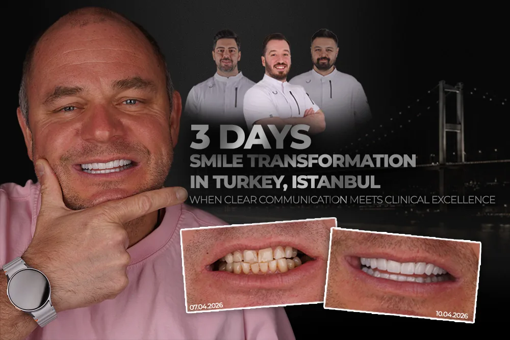 Three Day Smile Transformation in Turkey, Istanbul: When Clear Communication Meets Clinical Excellence