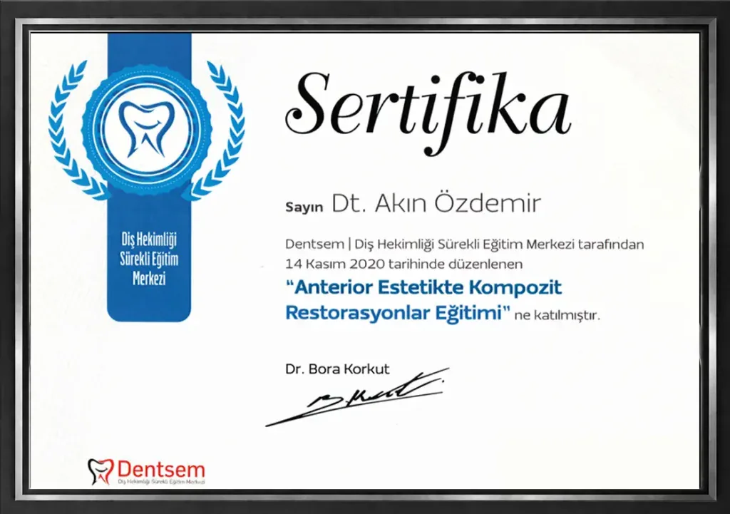 Composite Restorations in Anterior Aesthetics