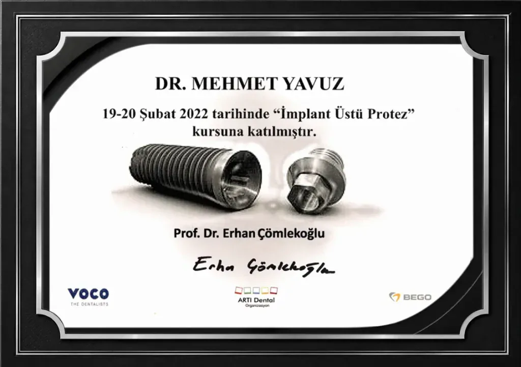 Implant Supported Prosthesis