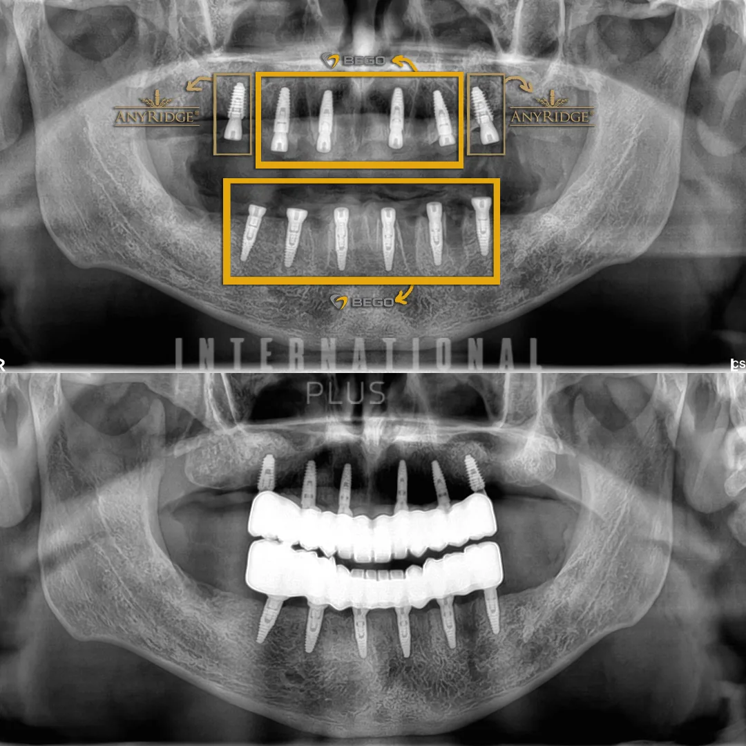 A Dental Journey from Romania