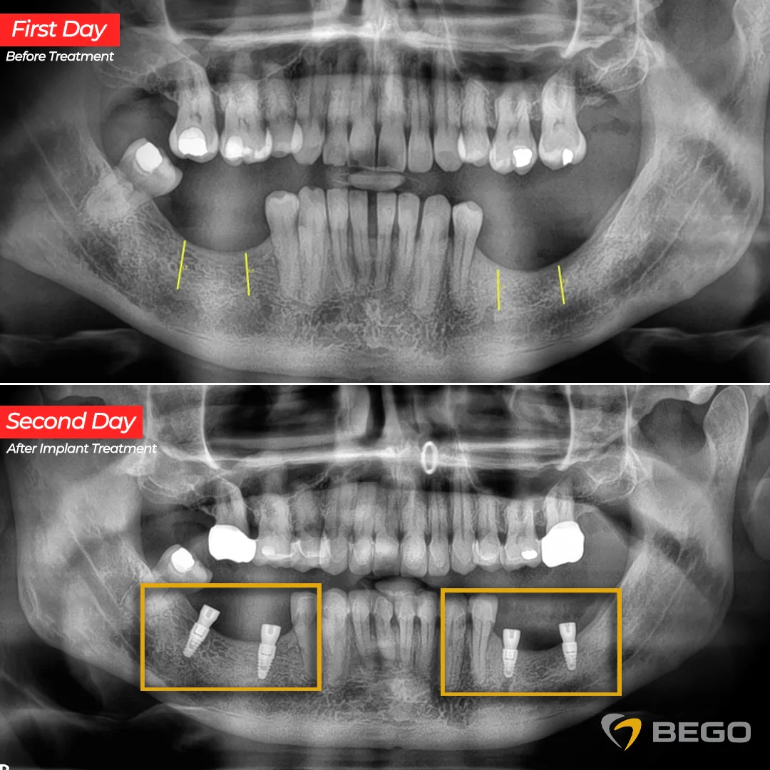 A Dental Journey from the UK