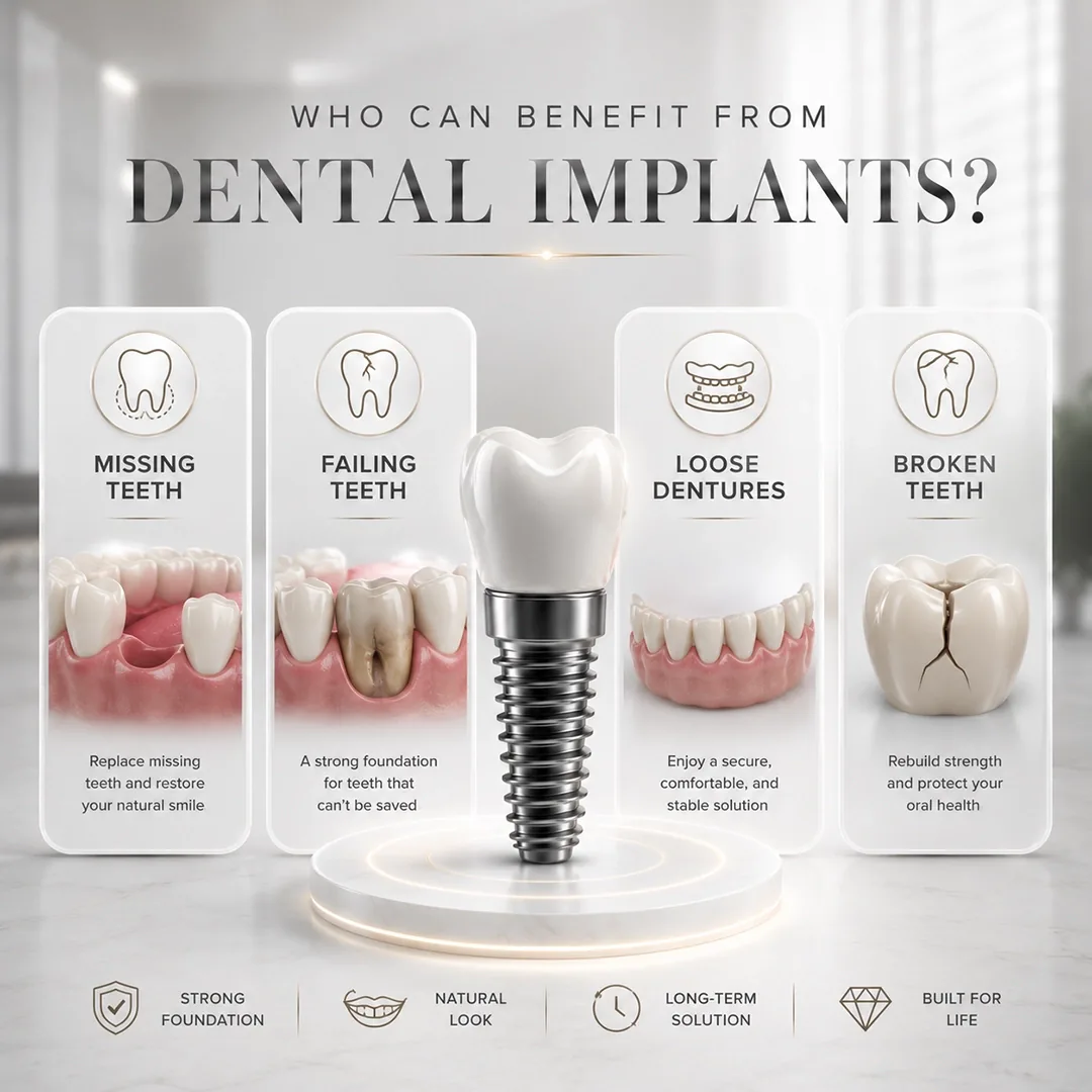 All On 4 Dental Implants Before After