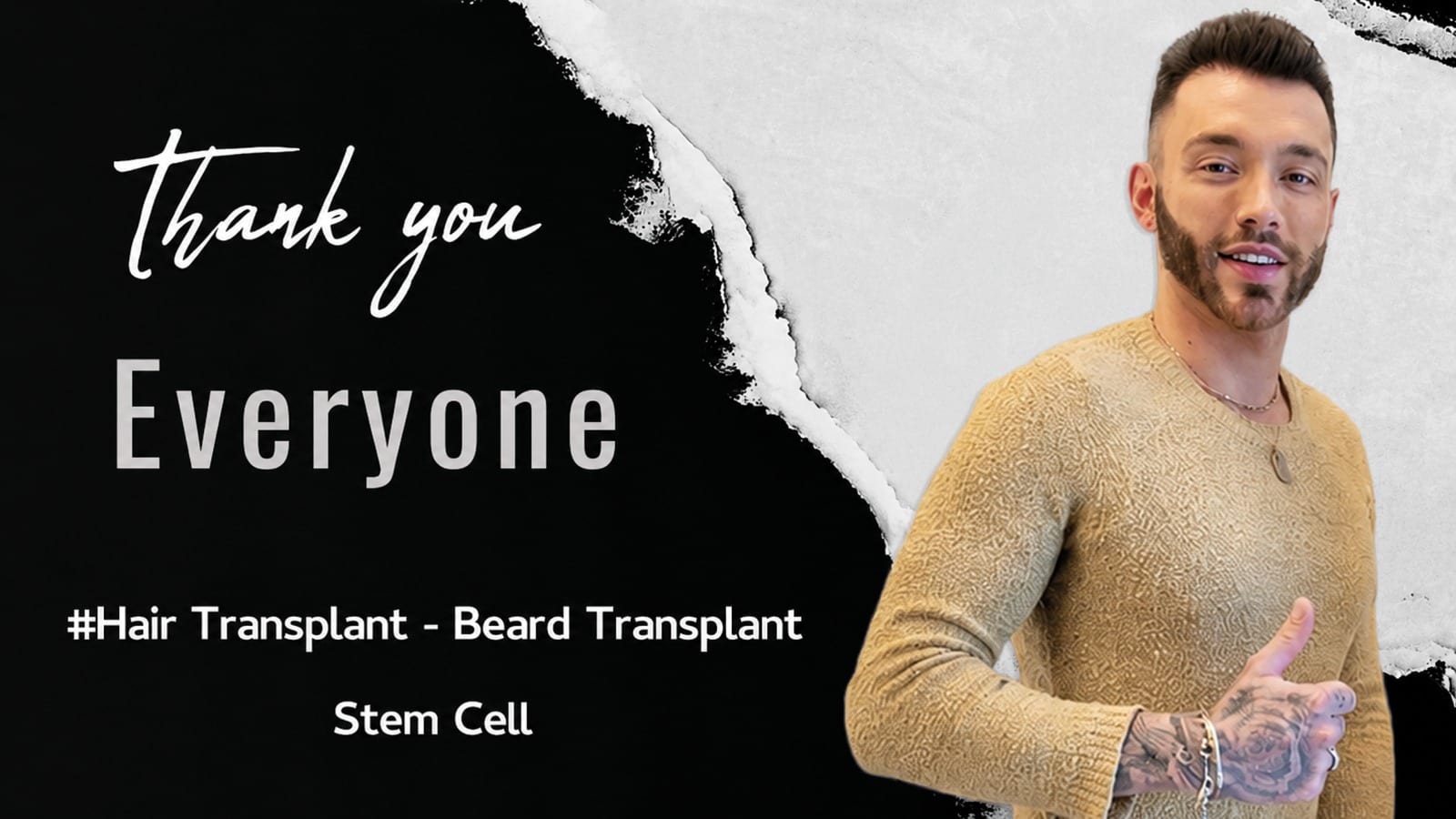 Beard-Transplant-in-istanbulTurkey