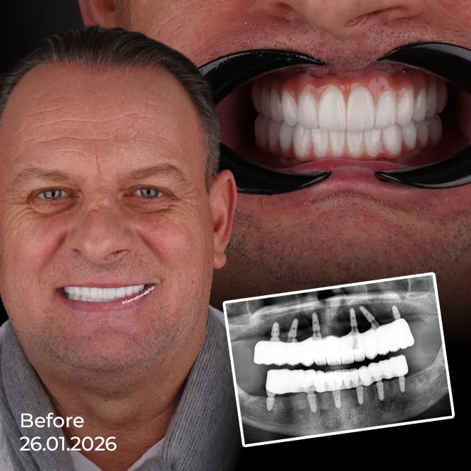 Dennis's Story A Failing Smile He Refused to Hide