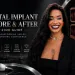 Dental Implant Before After 2026 Results Guide