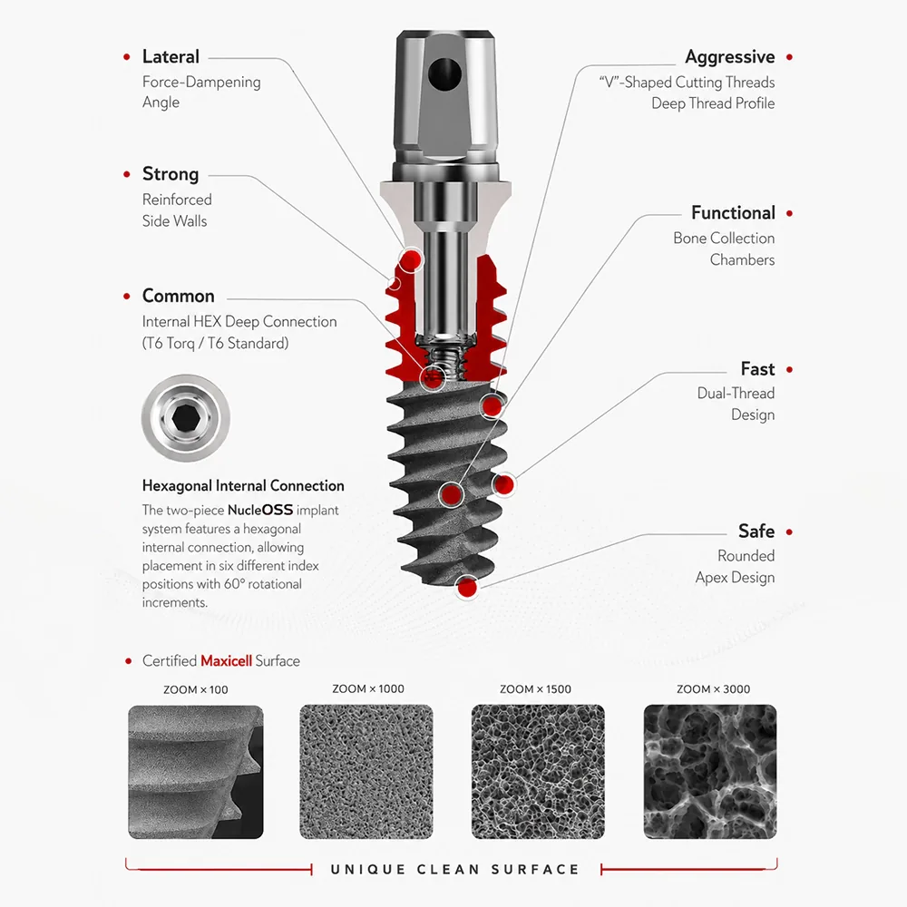 Digital Integration Nucleoss in CADCAM Workflows
