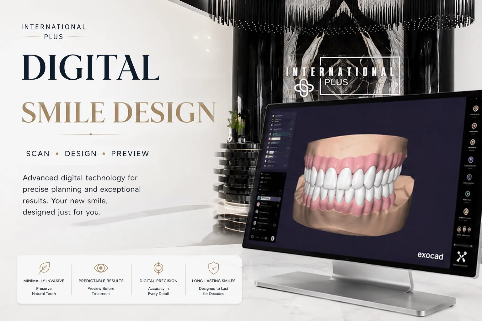 Digital Smile Design at International Plus: Precision