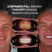 Full Mouth Toronto Bridge Case Study Stephan's Journey