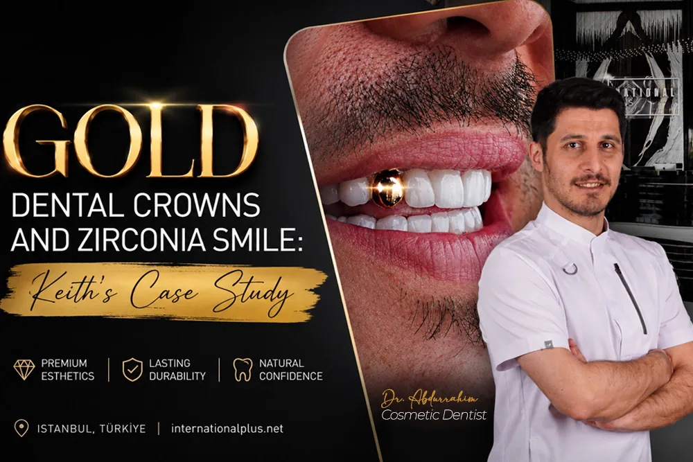 Gold Dental Crowns and Zirconia: Keith’s Case Study