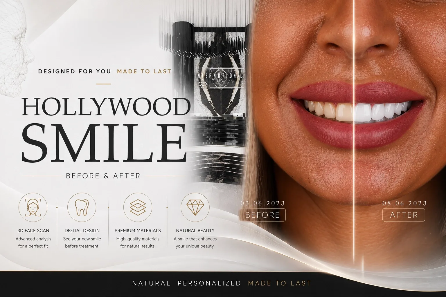 Hollywood Smile Before After: 2026 Trends Guide