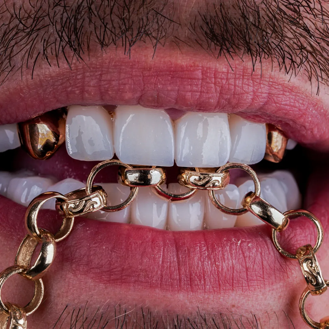 The Result One Natural Smile in Gold and Zirconia