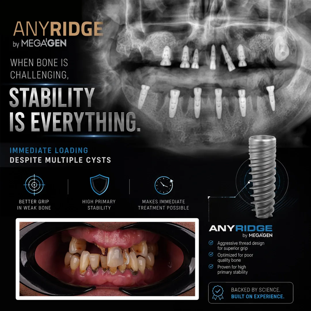 The Treatment Plan All in One Surgery