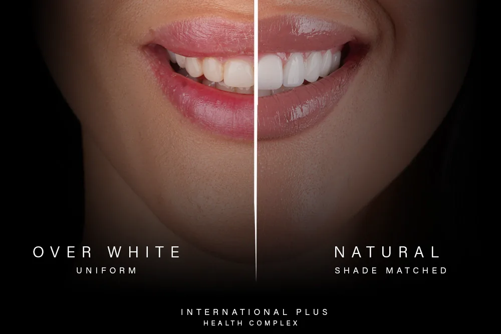 The Truth About Turkey Teeth: A Safe, Natural Smile