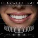 What Is a Hollywood Smile Treatments and Timeline