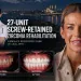 A 27 Unit Screw Retained Zirconia Rehabilitation Kamila's Recorded Case