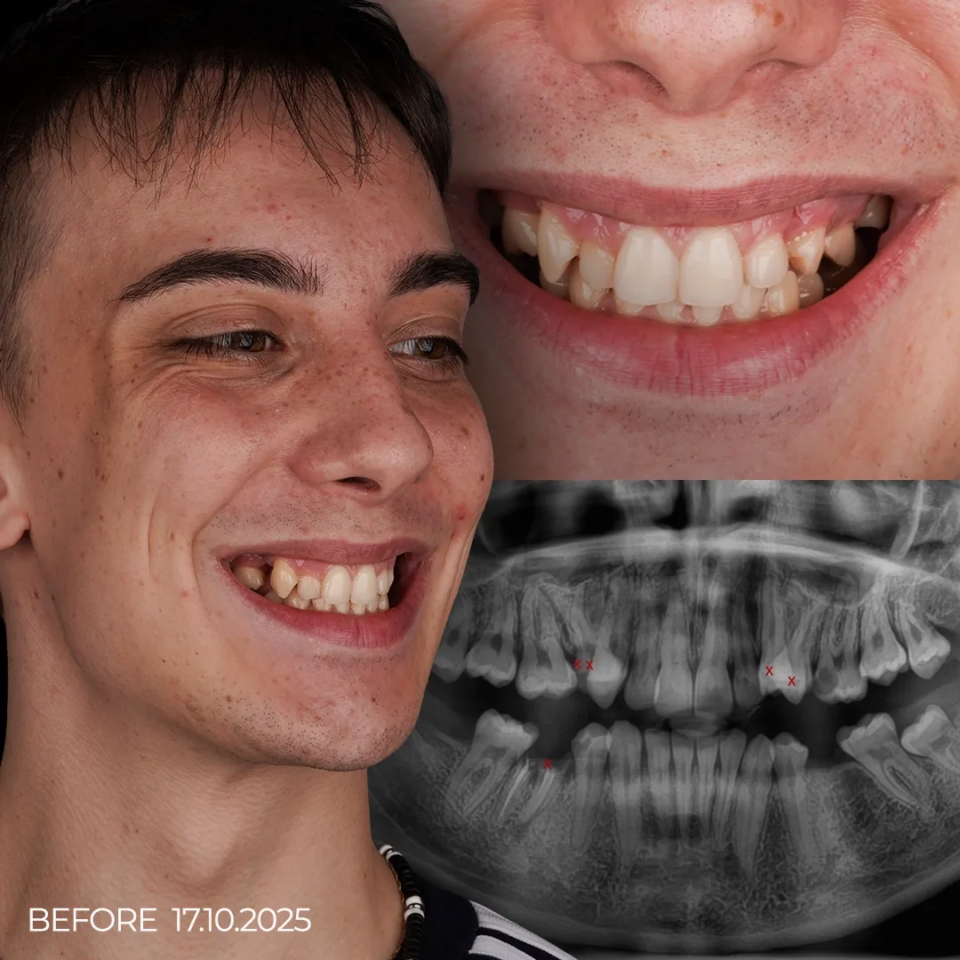 Aleksandr's Story A Long-Term Smile, Built Early