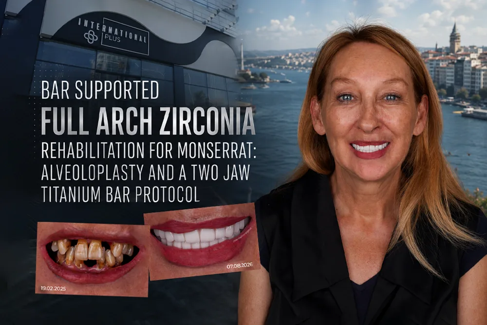 Bar Supported Full Arch Zirconia Rehabilitation for Monserrat: Alveoloplasty and a Two Jaw Titanium Bar Protocol